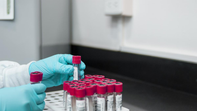 Mainīts SIA «Bauskas slimnīca» laboratorijas darba laiks