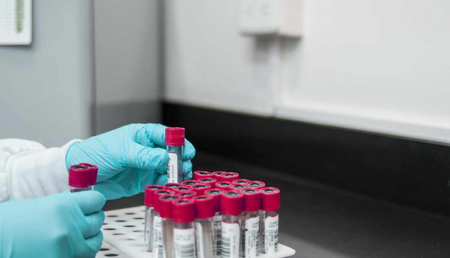 Mainīts SIA «Bauskas slimnīca» laboratorijas darba laiks